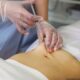 Fat Melting Injections in Islamabad, Pakistan