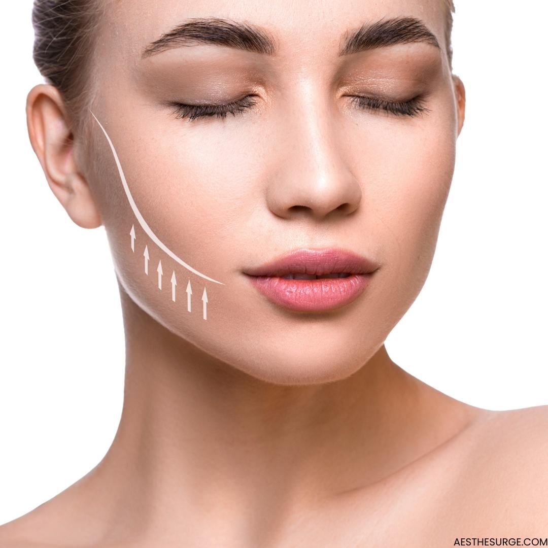 Non-Surgical Facelift Threading in Islamabad, Pakistan