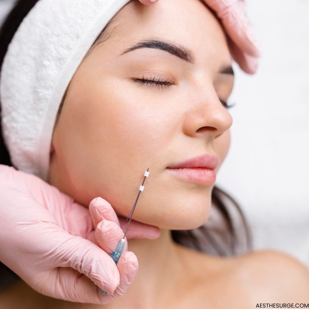 PDO Thread Lift Treatment in Islamabad