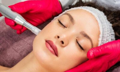 Microneedling Treatment Cost in Pakistan AestheSurge