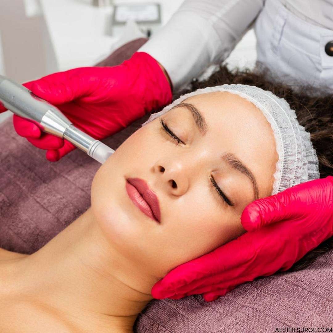 Microneedling Treatment Cost in Pakistan AestheSurge